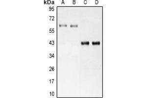 Western Blotting (WB) image for anti-Nuclear Receptor Subfamily 5, Group A, Member 2 (NR5A2) antibody (ABIN7308100)