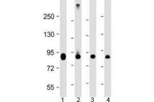 Western blot testing of human 1) HeLa, 2) Jurkat, 3) COS-7 and 4) mouse heart lysate with PFKP antibody at 1:4000. (PFKP Antikörper  (AA 40-300))