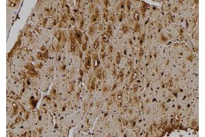 ABIN6259201 and ABIN6275855 at 1/100 staining Human heart tissue by IHC-P. (STK33 Antikörper  (N-Term))