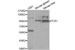 Western blot analysis of extracts of various cell lines, using TLR1 antibody. (TLR1 Antikörper  (AA 30-290))
