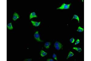 Immunofluorescence staining of A549 cells with ABIN7140223 at 1:50, counter-stained with DAPI. (CACNG6 Antikörper  (AA 22-39))