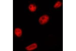 ABIN6275393 staining HepG2 by IF/ICC. (PRPF18 Antikörper  (Internal Region))