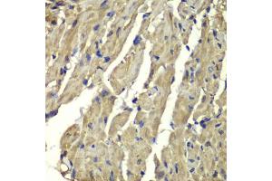 Immunohistochemistry of paraffin-embedded mouse heart using FXN antibody. (Frataxin Antikörper)