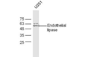 U251 lysates probed with Anti-Endothelial lipase Polyclonal Antibody, Unconjugated  at 1:5000 90min in 37˚C. (LIPG Antikörper  (AA 301-400))