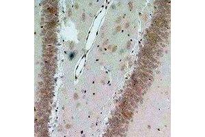 Immunohistochemical analysis of Bestrophin-2 staining in rat brain formalin fixed paraffin embedded tissue section. (Bestrophin 2 Antikörper)
