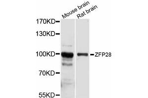Western blot analysis of extracts of various cell lines, using ZFP28 antibody (ABIN6293840) at 1:1000 dilution. (ZFP28 Antikörper)