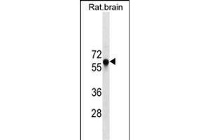 GAD2 Antibody ABIN1539900 western blot analysis in rat brain tissue lysates (35 μg/lane). (GAD65 Antikörper  (AA 109-138))