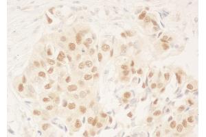 anti-DDB1 and CUL4 Associated Factor 6 (DCAF6) (AA 600-650) antibody