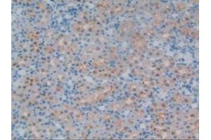 Immunohistochemistry (IHC) image for anti-Chondroitin Sulfate Proteoglycan 5 (Neuroglycan C) (CSPG5) (AA 139-370) antibody (ABIN7442075)