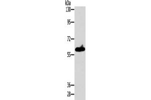 Gel: 8 % SDS-PAGE, Lysate: 40 μg, Lane: A549 cells, Primary antibody: ABIN7128549(ASB3 Antibody) at dilution 1/200, Secondary antibody: Goat anti rabbit IgG at 1/8000 dilution, Exposure time: 10 seconds (ASB3 Antikörper)