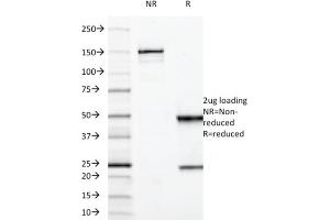 SDS-PAGE Analysis Purified MUC3 Mouse Monoclonal Antibody (M3. (MUC3A Antikörper)