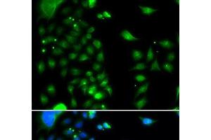 Immunofluorescence analysis of MCF-7 cells using UBE2J2 Polyclonal Antibody (UBE2J2 Antikörper)