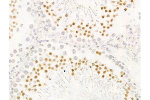 ABIN7094792 and ABIN7098843 at 1/100 staining Rat testis tissue by IHC-P. (KDM5C Antikörper  (C-Term))