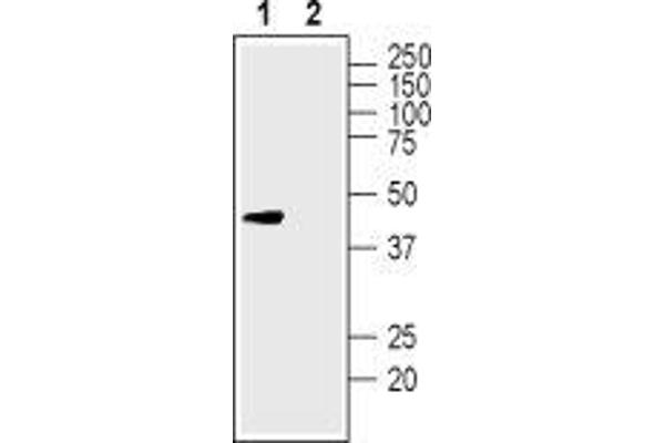 KCNK12 Antikörper  (1st Extracellular Loop)