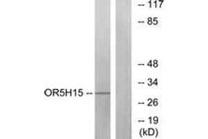 Western blot analysis of extracts from COLO cells, using OR5H15 Antibody. (OR5H15 Antikörper  (AA 241-290))