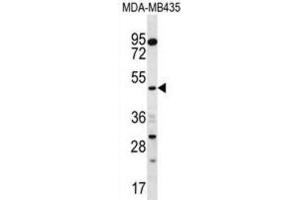 Western Blotting (WB) image for anti-Sorting Nexin 4 (SNX4) antibody (ABIN2996990) (Sorting Nexin 4 Antikörper)