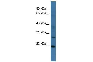 Western Blot showing STARD4 antibody used at a concentration of 1-2 ug/ml to detect its target protein. (STARD4 Antikörper  (Middle Region))