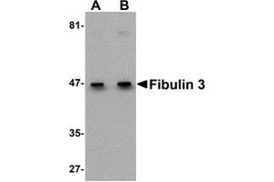 Western Blotting (WB) image for anti-Fibulin 3 (FBLN3) (C-Term) antibody (ABIN1030395) (FBLN3 Antikörper  (C-Term))