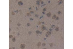 IHC-P analysis of Mouse Tissue, with DAB staining. (CRH Antikörper  (AA 28-160))
