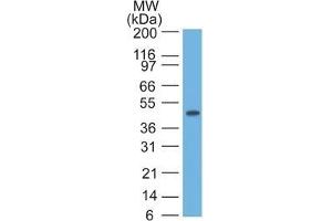 Western blot of HeLa lysate using CK17 Monoclonal Antibody (SPM560). (KRT17 Antikörper)