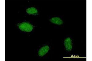 Immunofluorescence of purified MaxPab antibody to POGZ on HeLa cell. (POGZ Antikörper  (AA 1-1357))