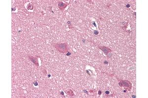 Anti-DCK antibody IHC of human brain, cortex.