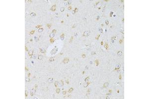 Immunohistochemistry of paraffin-embedded rat brain using NTS antibody (ABIN5998396) at dilution of 1/100 (40x lens). (Neurotensin Antikörper)