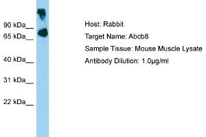 WB Suggested Anti-Abcb8 Antibody   Titration: 1. (ABCB8 Antikörper  (Middle Region))