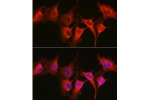 Immunofluorescence analysis of C6 cells using HSP70/HSP Rabbit pAb  at dilution of 1:250 (40x lens). (HSP70 1A Antikörper  (C-Term))