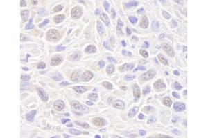 Immunohistochemistry (IHC) image for anti-RAD50 Homolog (S. Cerevisiae) (RAD50) (AA 700-750) antibody (ABIN7448751) (RAD50 Antikörper  (AA 700-750))