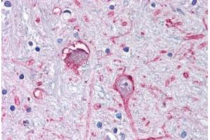Anti-GABRA3 antibody  ABIN1048638 IHC staining of human brain, globus pallidus. (GABRA3 Antikörper  (C-Term))