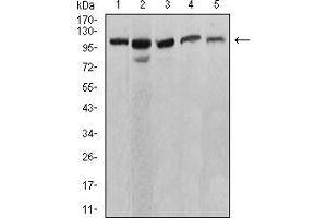 Western blot analysis using ATP2A1 mouse mAb against C2C12 (1), COS7 (2), Hela (3), K562 (4), and Jurkat (5) cell lysate. (ATP2A1/SERCA1 Antikörper  (AA 487-631))