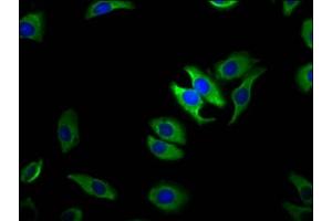 Immunofluorescence staining of A549 cells with ABIN7172853 at 1:100, counter-stained with DAPI. (TRPM1 Antikörper  (AA 1-97))