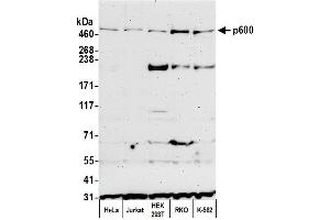 Western Blotting (WB) image for anti-Ubiquitin Protein Ligase E3 Component N-Recognin 4 (UBR4) (AA 1350-1400) antibody (ABIN7454815) (UBR4 Antikörper  (AA 1350-1400))