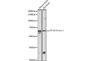 Western Blotting (WB) image for anti-Ribosomal Protein S6 Kinase, 70kDa, Polypeptide 1 (RPS6KB1) (AA 361-525) antibody (ABIN7270029)