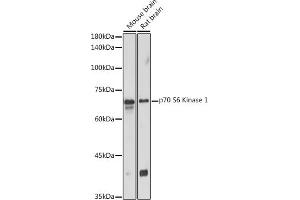 Western blot analysis of extracts of various cell lines, using p70 S6 Kinase 1 1 antibody (ABIN7270029) at 1:1000 dilution. (RPS6KB1 Antikörper  (AA 361-525))