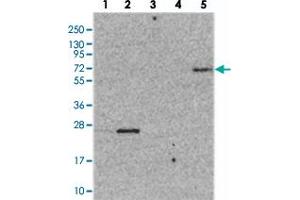 Western blot analysis of Lane 1: RT-4, Lane 2: U-251 MG, Lane 3: Human Plasma, Lane 4: Liver, Lane 5: Tonsil with ZNF623 polyclonal antibody  at 1:250-1:500 dilution.