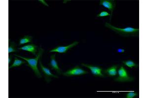Immunofluorescence of purified MaxPab antibody to PLOD2 on HeLa cell. (PLOD2 Antikörper  (AA 1-758))