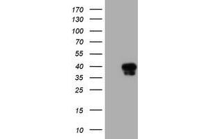 Western Blotting (WB) image for anti-serpin Peptidase Inhibitor, Clade A (Alpha-1 Antiproteinase, Antitrypsin), Member 5 (SERPINA5) antibody (ABIN1500056) (SERPINA5 Antikörper)