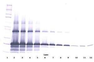 Image no. 1 for anti-WNT1 Inducible Signaling Pathway Protein 2 (WISP2) antibody (ABIN465385) (WISP2 Antikörper)