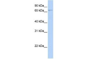 WB Suggested Anti-GLMN Antibody Titration: 0. (GLMN Antikörper  (N-Term))