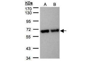 WB Image Sample(30 μg of whole cell lysate) A:Hep G2, B:MOLT4, 7. (STIP1 Antikörper)
