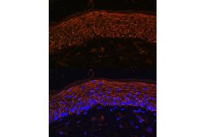 Immunofluorescence analysis of Mouse skin using  Rabbit pAb (ABIN6134303, ABIN6136434, ABIN6136435 and ABIN6216449) at dilution of 1:100. (CXCR7 Antikörper  (AA 50-150))