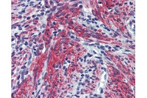 Immunohistochemistry (IHC) image for anti-Periostin (POSTN) (Middle Region) antibody (ABIN2776883)