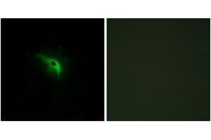 Immunofluorescence analysis of A549 cells, using TPIP1 Antibody. (TP53AIP1 Antikörper  (AA 75-124))