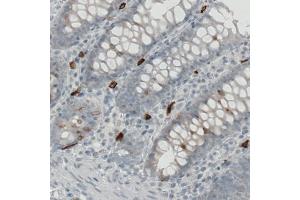 Immunohistochemical staining (Formalin-fixed paraffin-embedded sections) of human colon with KIT monoclonal antibody, clone CL1667  shows strong immunoreactivity in some lymphoid cells. (KIT Antikörper  (AA 50-190))