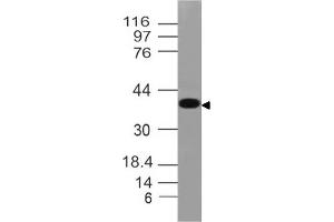 Image no. 1 for anti-N-Myc Downstream Regulated 1 (NDRG1) (AA 123-318) antibody (ABIN5027495) (NDRG1 Antikörper  (AA 123-318))