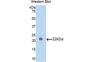 Western blot analysis of the recombinant protein. (IL18BP Antikörper  (AA 29-193))