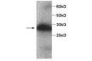 Image no. 1 for anti-serpin Peptidase Inhibitor, Clade B (Ovalbumin), Member 4 (SERPINB4) antibody (ABIN791515) (SERPINB4 Antikörper)