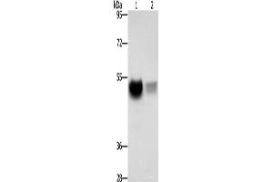 Western blot analysis of Mouse brain tissue PC3 cells using CREBZF Polyclonal Antibody at dilution of 1:500 (CREBZF Antikörper)